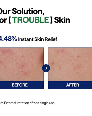 Teatree Calming Hydra Serum