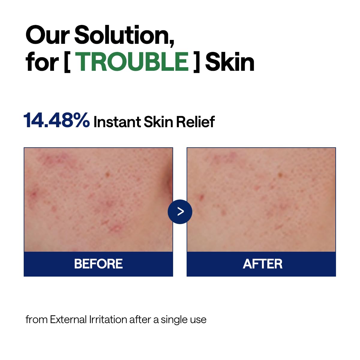 Teatree Calming Hydra Serum