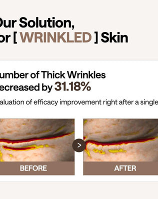 Retinol Collagen Eye Ampoule Patch