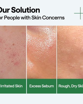 Teatree Calming Hydra Serum