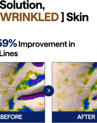 Retinol Collagen Lifting Pad