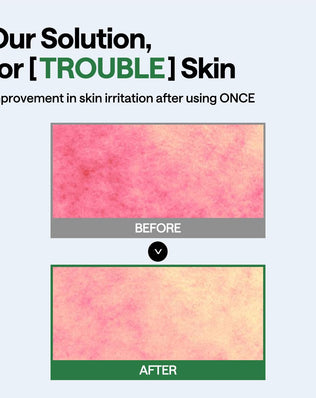 Teatree Wrapping Serum Mask