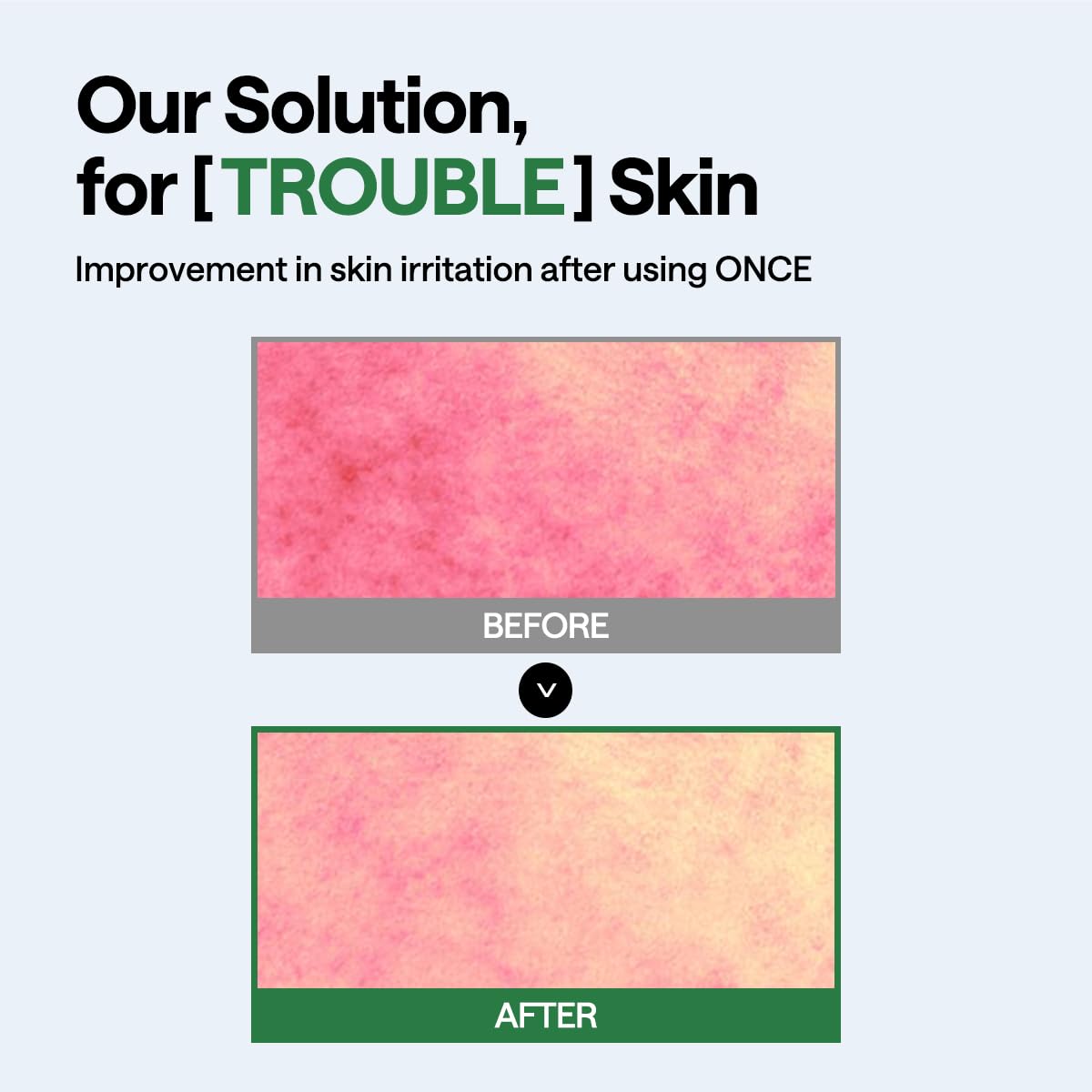 Teatree Wrapping Serum Mask