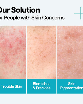 Madecassoside Blemish Repair Serum