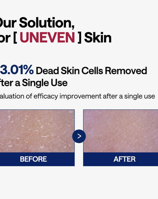 Phyto-enzyme Peeling Pad