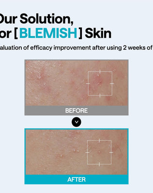 Mediheal Madecassoside Wrapping Serum Mask