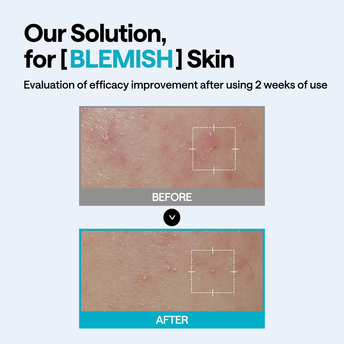 Mediheal Madecassoside Wrapping Serum Mask