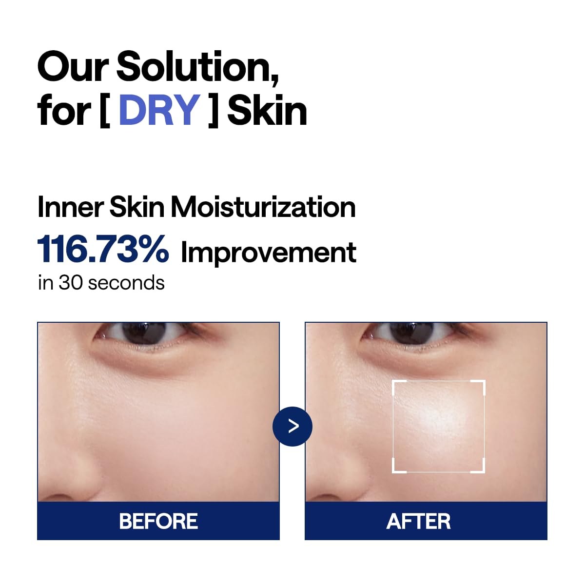 Watermide Moisture Pad