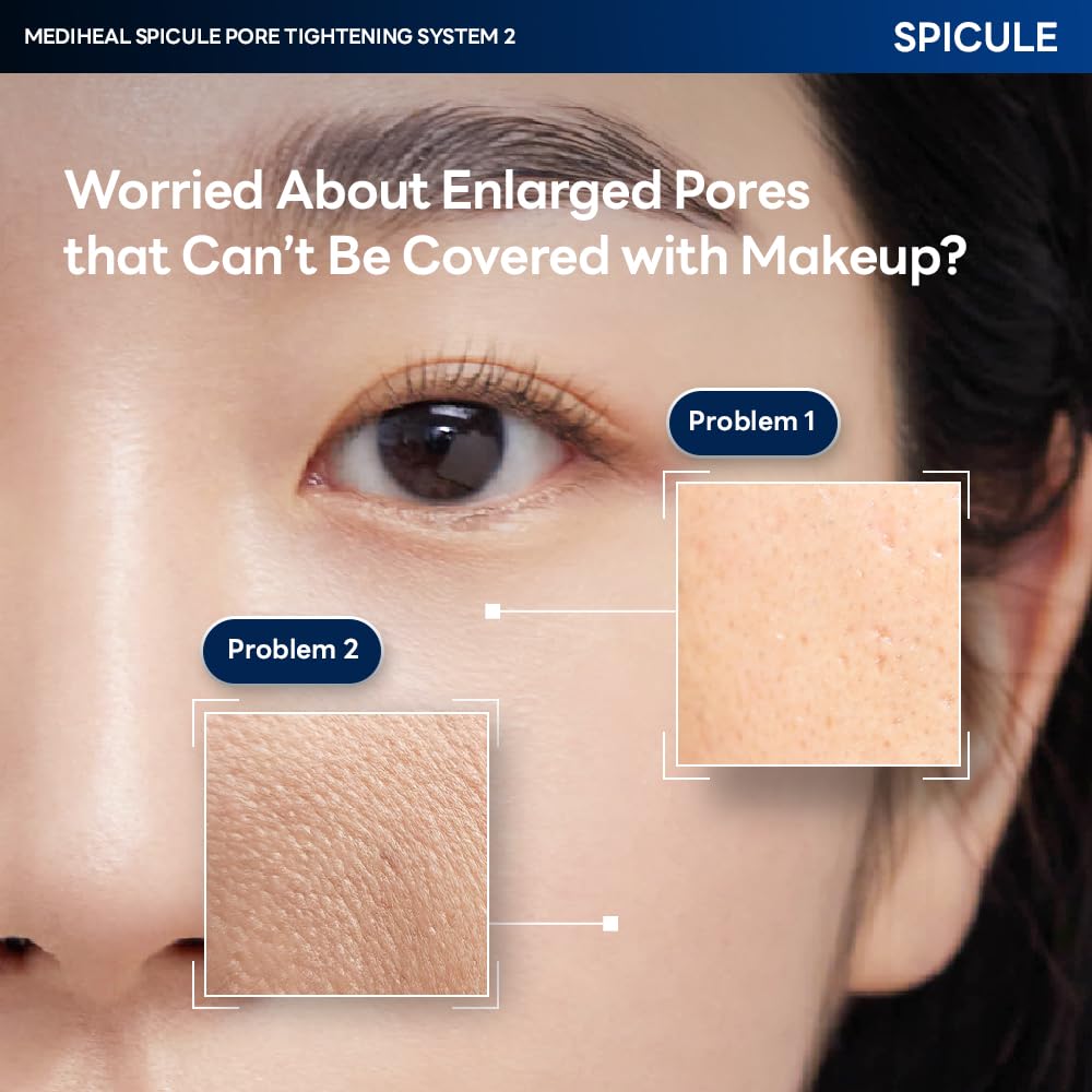Spicule Pore Tightening System 1 – Mediheal US