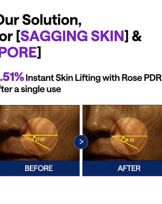 PDRN Lifting Serum