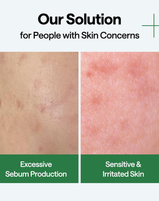 Teatree Wrapping Serum Mask