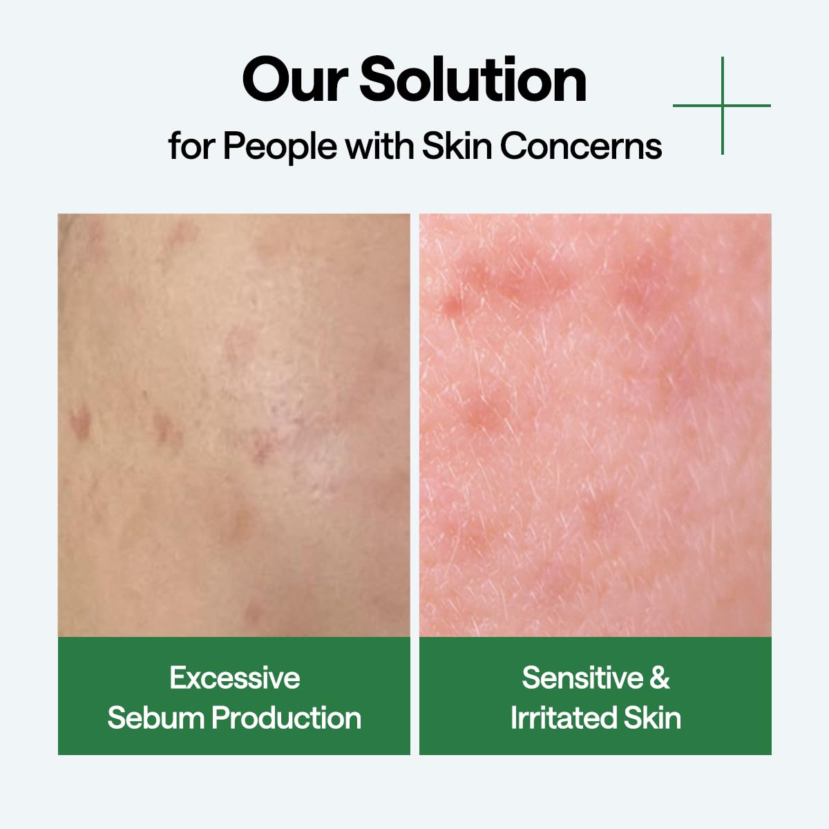 Teatree Wrapping Serum Mask