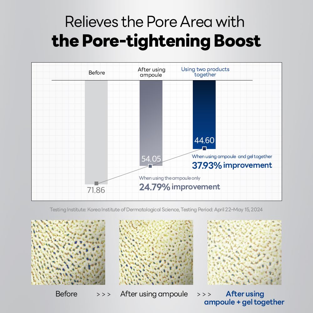 Spicule Pore Tightening System 1 - [brand_name]