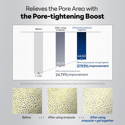 Spicule Pore Tightening System 1 - [brand_name]