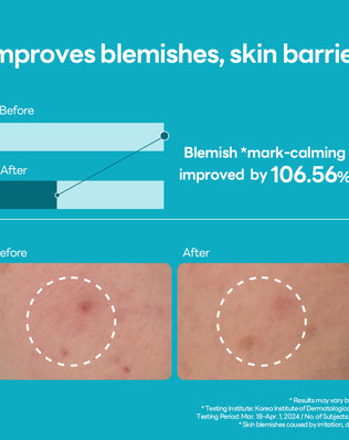 Madecassoside Blemish Repair Serum - [brand_name]