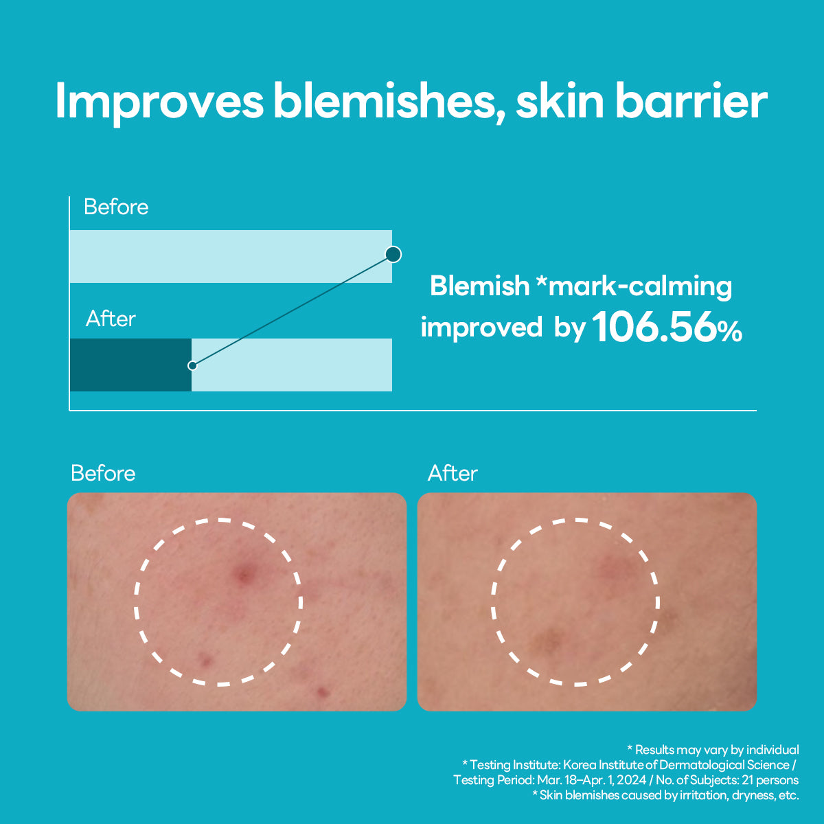 Madecassoside Blemish Repair Serum - [brand_name]