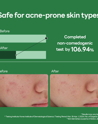 Teatree Calming Hydra Serum - [brand_name]