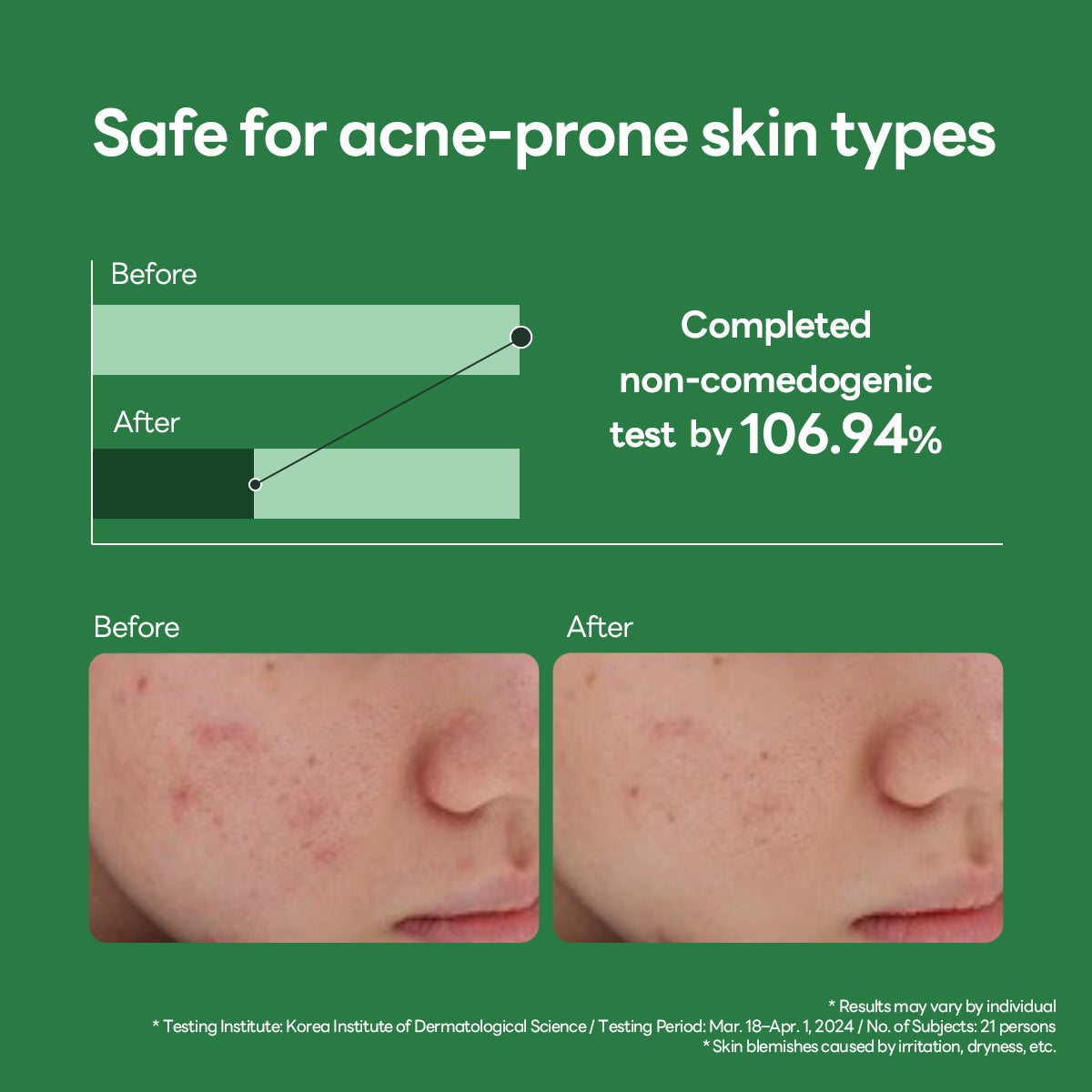 Teatree Calming Hydra Serum - [brand_name]