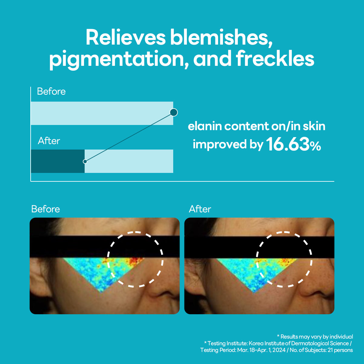 Madecassoside Blemish Repair Serum - [brand_name]