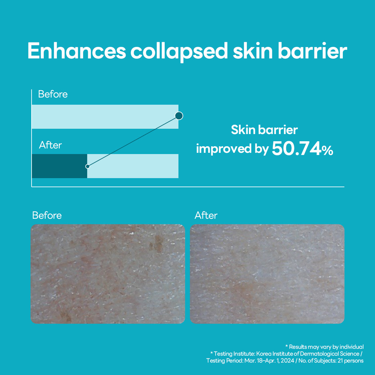 Madecassoside Blemish Repair Serum - [brand_name]